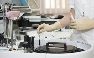 明暗が分かれる開発ステップ 新規事業・新商品を生み出す技術戦略（その37）